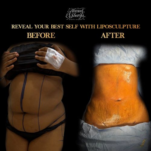 لماذا تختار د. أحمد الشريفة؟